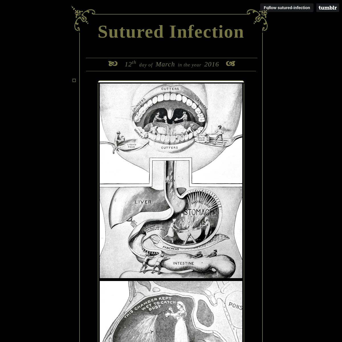 A complete backup of sutured-infection.tumblr.com