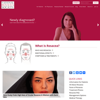A complete backup of rosacea.org