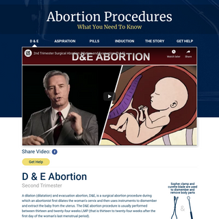 A complete backup of abortionprocedures.com