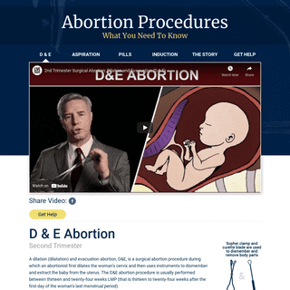 D & E Abortion Procedure - What You Need To Know