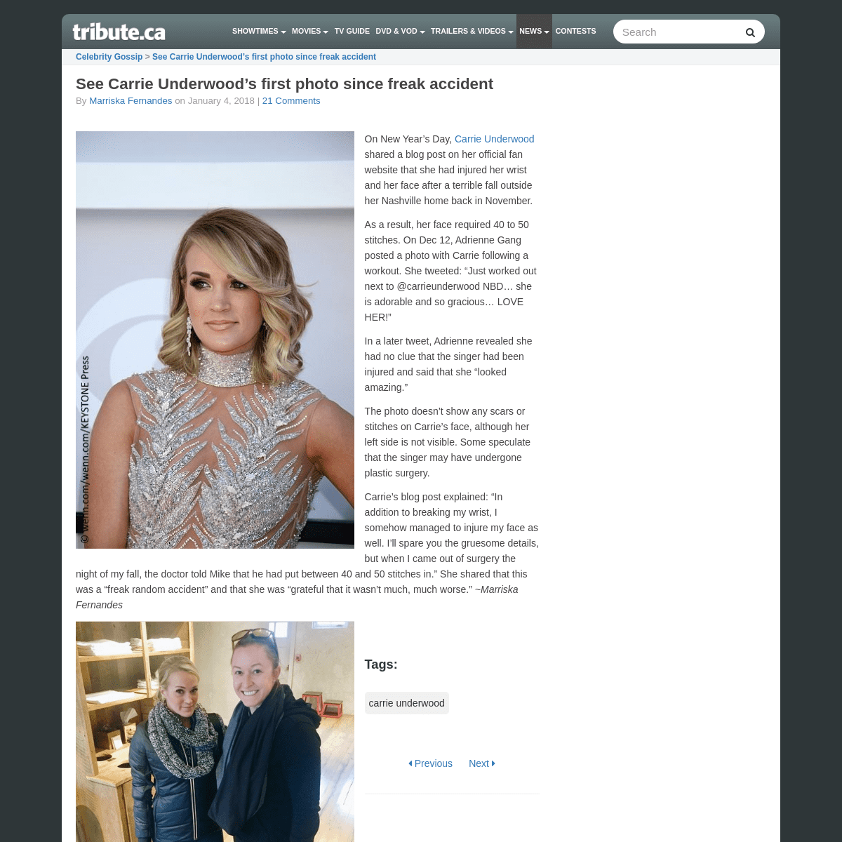 A complete backup of https://www.tribute.ca/news/carrie-underwood-pictured-for-first-time-since-freak-accident/2018/01/04/